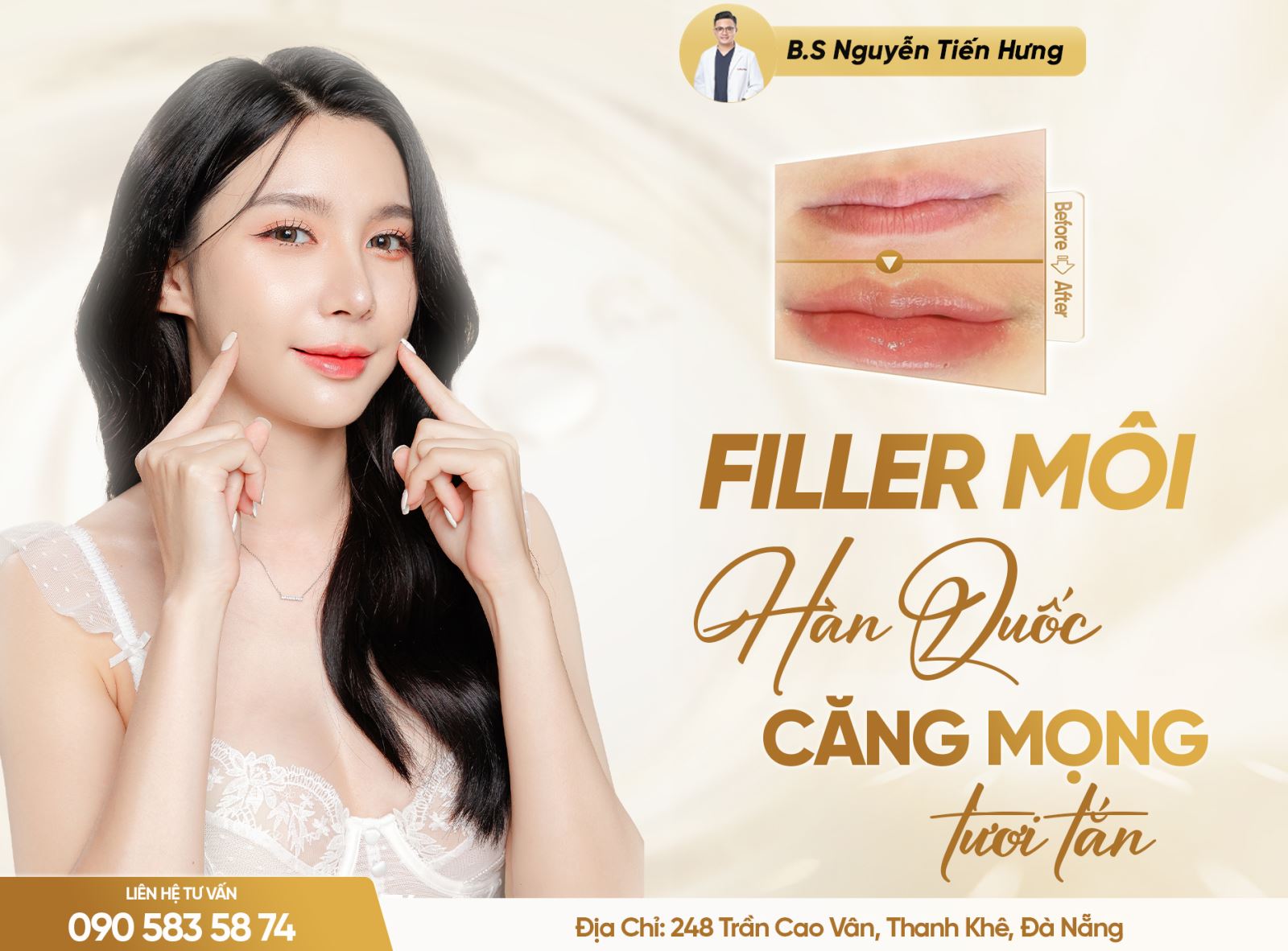 Filler môi Hàn Quốc Bí quyết cho đôi môi căng mọng tươi tắn